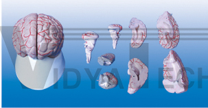 The model of brain and cerebral arteries distributing